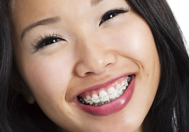 Young woman wearing braces on her teeth
