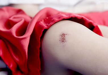 A scrape on the knee